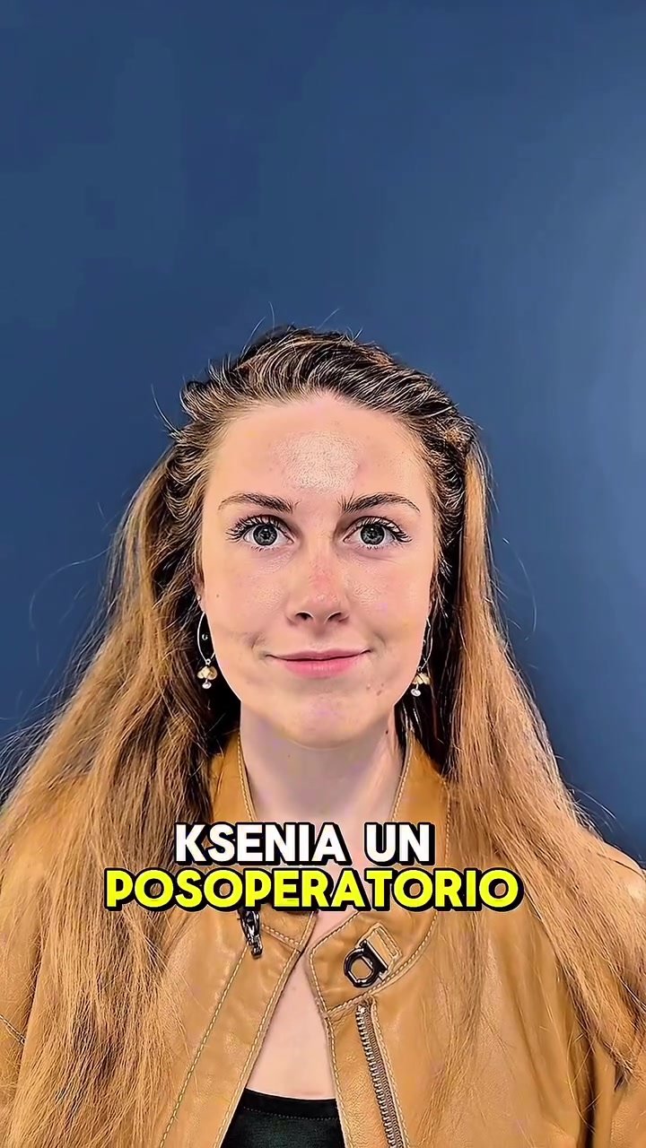 Caso de septorrinoplastia cerrada con evolución postoperatoria