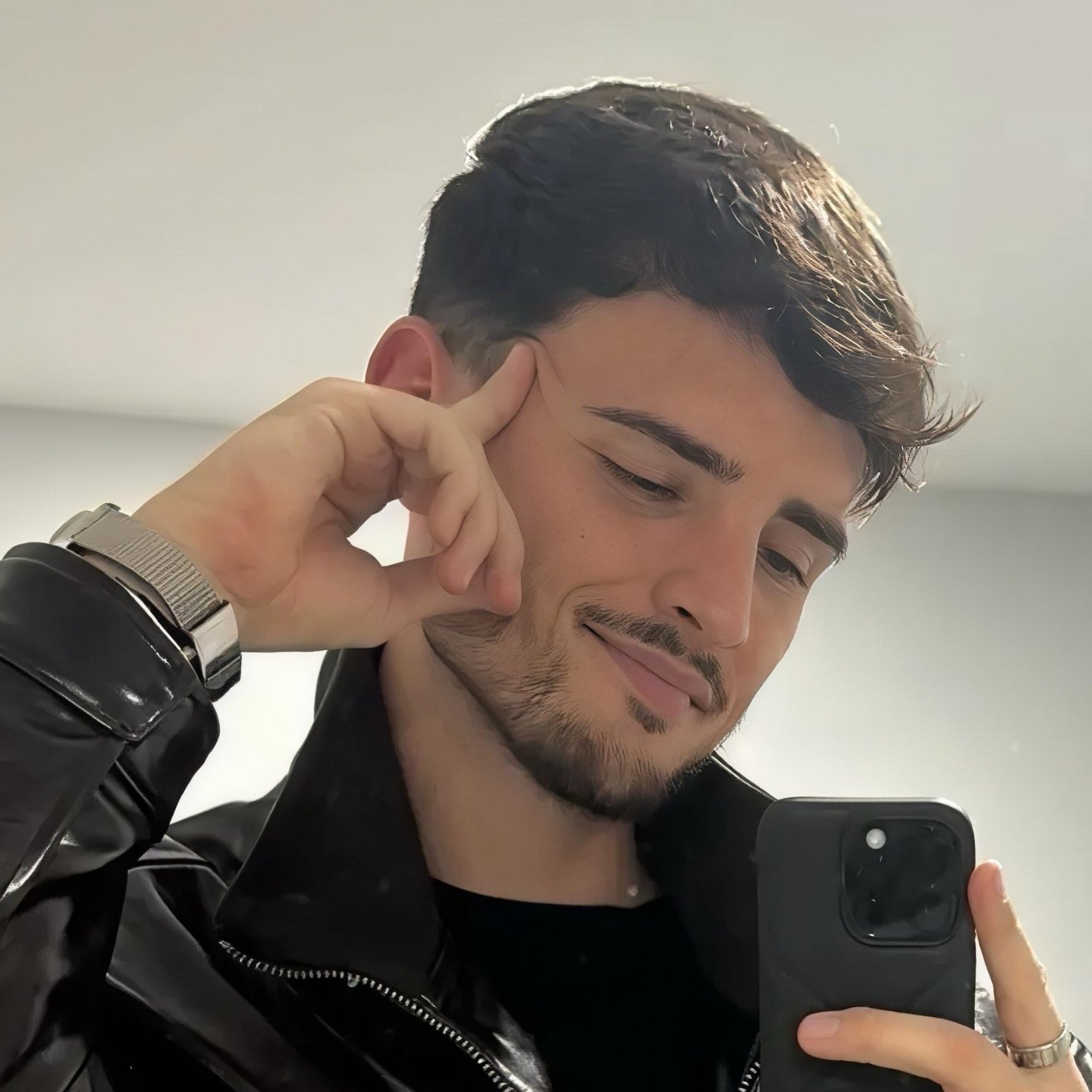 Resultado natural de rinoplastia masculina a los doce meses